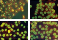 リウマトイド因子写真